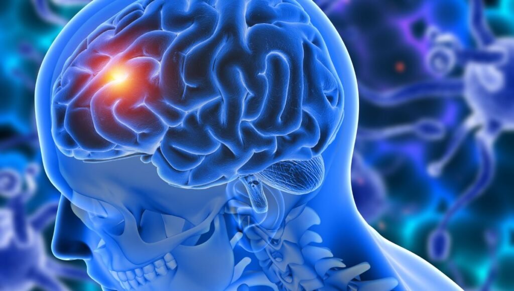 Brain Tumors: Essential Facts and Information”